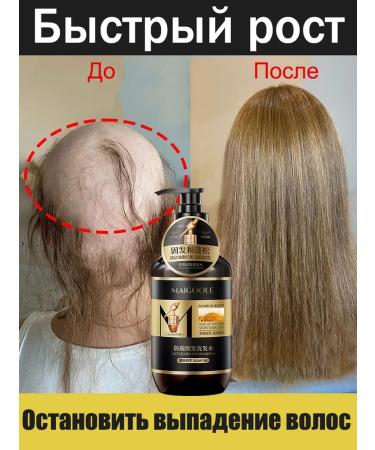 LYDIMOON Hair growth shampoo and 200ml loss