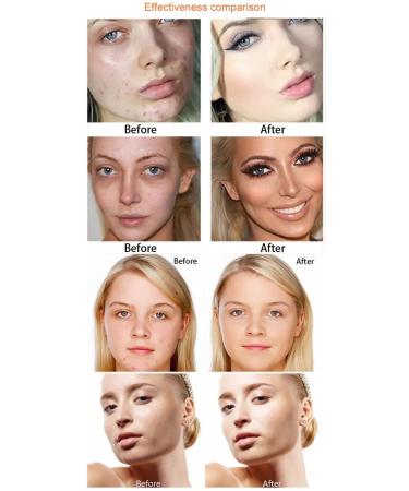 Concealer 15ml - Buy Online on GoSupps.com