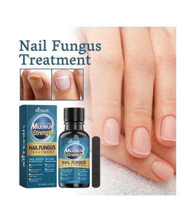 Ximonth nail fungus Care - Buy Online on GoSupps.com