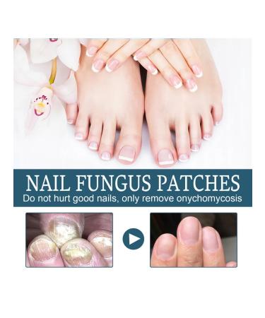 Ximonth nail fungus Care - Buy Online on GoSupps.com