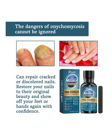 Ximonth nail fungus Care - Buy Online on GoSupps.com