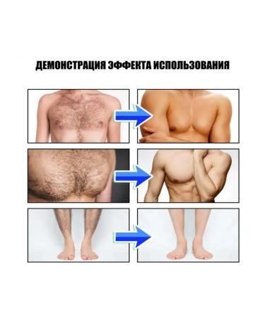 eelhoe Musa removal men not irritate the skin of 2pcs - Buy Online on GoSupps.com