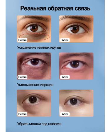 LYDIMOON Anti -aging eyelid edema and bags under the eyes of 40 g - Buy Online on GoSupps.com