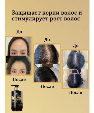 LYDIMOON 5 bottles of shampoo against hair loss - Buy Online on GoSupps.com