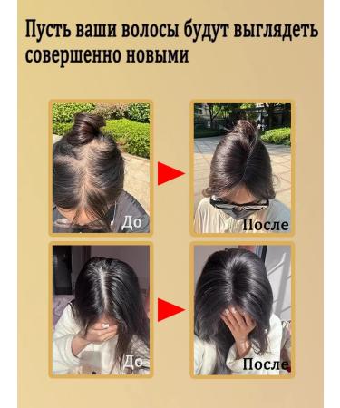 LYDIMOON 5 bottles of shampoo against hair loss - Buy Online on GoSupps.com