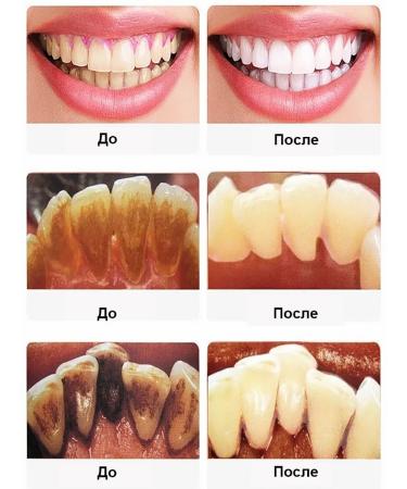 LYDIMOON Toothpaste to remove tooth stone and bleaching teeth - Buy Online on GoSupps.com