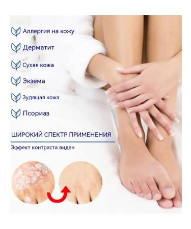 DRSKINVITA Chinese miracle cream from psoriasis and dermatitis - Buy Online on GoSupps.com