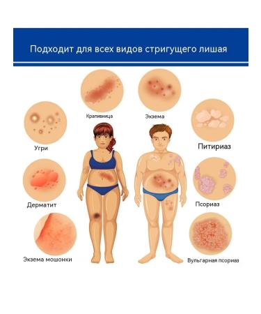 DRSKINVITA Chinese miracle cream from psoriasis and dermatitis - Buy Online on GoSupps.com