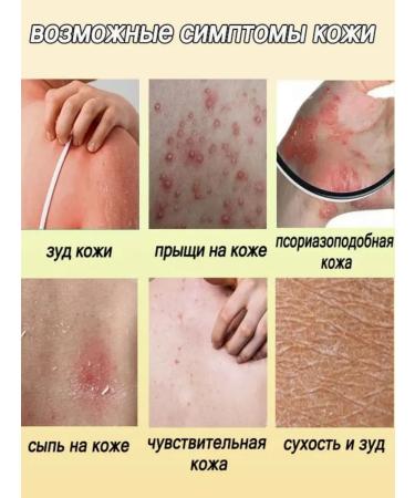 DRSKINVITA Chinese miracle cream from psoriasis and dermatitis - Buy Online on GoSupps.com