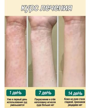 DRSKINVITA Chinese miracle cream from psoriasis and dermatitis - Buy Online on GoSupps.com