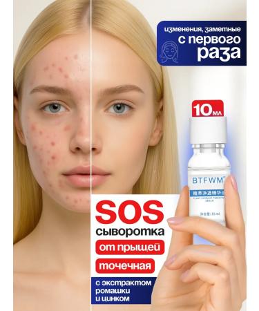 Plant acne remedy 10 ml