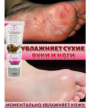 DRSKINVITA Hand cream moisturizing with snail mucus extract