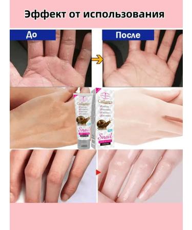 DRSKINVITA Hand cream moisturizing with snail mucus extract - Buy Online on GoSupps.com