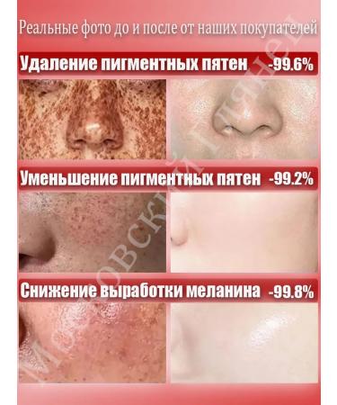 LYDIMOON Mask with collagen against wrinkles and moisture - Buy Online on GoSupps.com