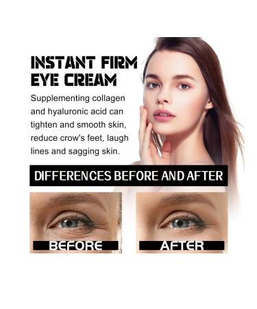 Eelhoe cream for tightening and elasticity of the skin around the eyes - Buy Online on GoSupps.com