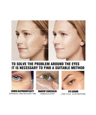 Eelhoe cream for tightening and elasticity of the skin around the eyes - Buy Online on GoSupps.com