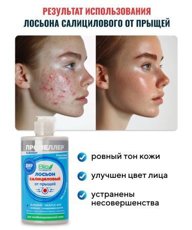 PROPELLER Salicylic lotion from acne for a comb. skin 460 ml - Buy Online on GoSupps.com