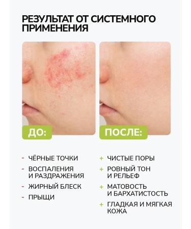 Y&B Toner for problem skin and face wash gel set for washing - Buy Online on GoSupps.com