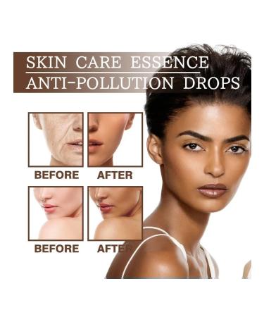 Eelhoejeeprome of a car gap for a face with Effeck fixing 3 pcs - Buy Online on GoSupps.com