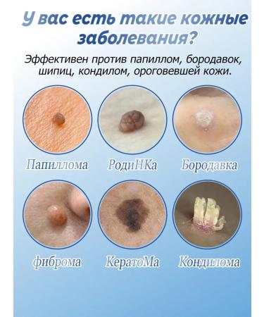 Cream for quick removal of papillomas and warts - Buy Online on GoSupps.com