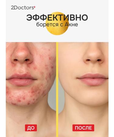 2Doctors From acne for face and problem skin - Buy Online on GoSupps.com
