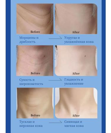 LYDIMOON Mask for neck against wrinkles 10 pieces - Buy Online on GoSupps.com