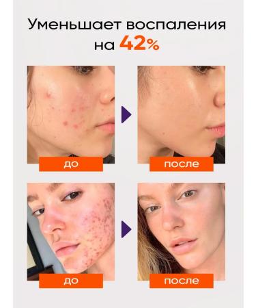 EDEN Serum for problematic skin from acne and acne 30 ml - Buy Online on GoSupps.com