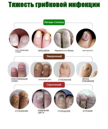 DRSKINVITA Japan ointment from nail fungus - Buy Online on GoSupps.com