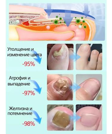 DRSKINVITA Japan ointment from nail fungus - Buy Online on GoSupps.com