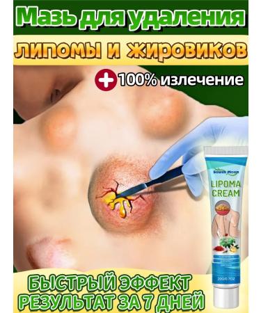 DRSKINVITA Ointment from Lipoma and Giroviks