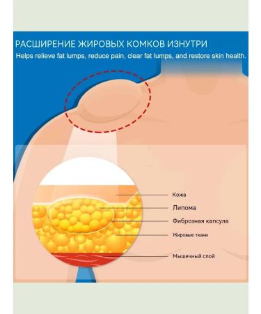 DRSKINVITA Ointment from Lipoma and Giroviks - Buy Online on GoSupps.com