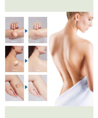 DRSKINVITA Ointment from Lipoma and Giroviks - Buy Online on GoSupps.com