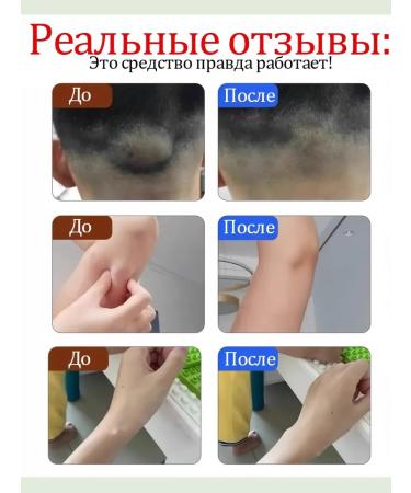 DRSKINVITA Ointment from Lipoma and Giroviks - Buy Online on GoSupps.com