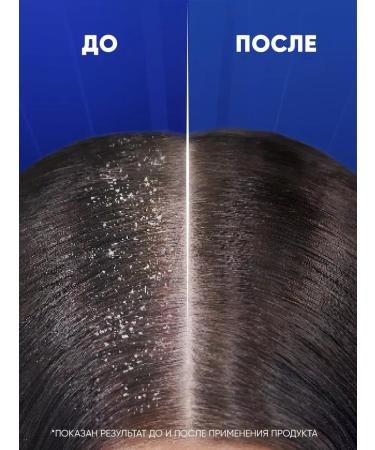 Head & Shoulders Shampoo from dandruff 7V1 against hair loss 300 ml - Buy Online on GoSupps.com