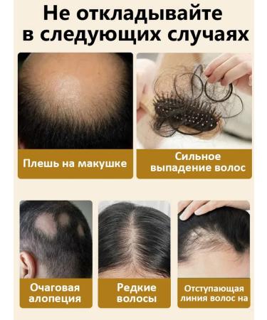 Shampoo for hair growth and loss with ginger and ginseng - Buy Online on GoSupps.com