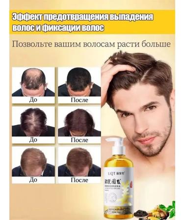 Shampoo for hair growth and loss with ginger and ginseng - Buy Online on GoSupps.com