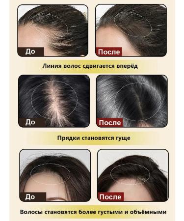 Shampoo for hair growth and loss with ginger and ginseng - Buy Online on GoSupps.com