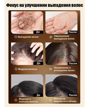 Shampoo for hair growth and loss with ginger and ginseng - Buy Online on GoSupps.com
