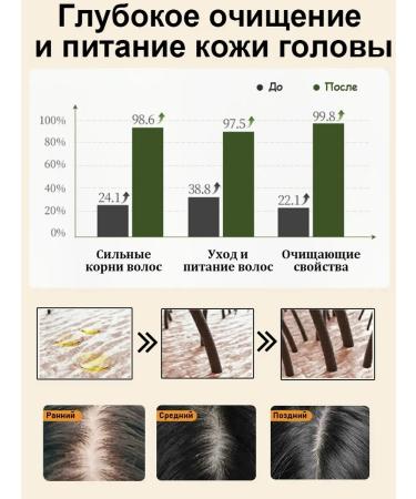 Shampoo for hair growth and loss with ginger and ginseng - Buy Online on GoSupps.com