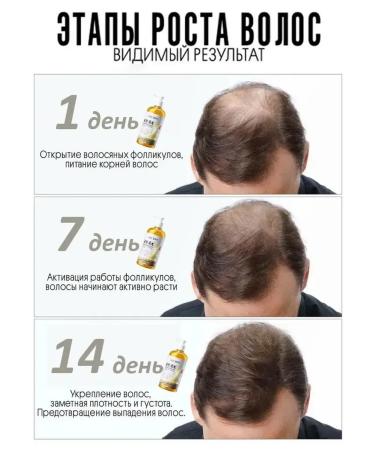 Shampoo for hair growth and loss with ginger and ginseng - Buy Online on GoSupps.com