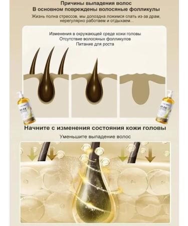 Shampoo for hair growth and loss with ginger and ginseng - Buy Online on GoSupps.com