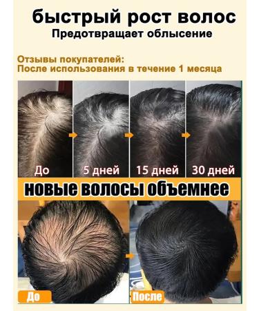 LYDIMOON Hair growth serum effective thickening 120ml - Buy Online on GoSupps.com