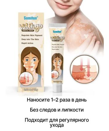 MIOSH Vitiligo and white spots even skin tone - Buy Online on GoSupps.com