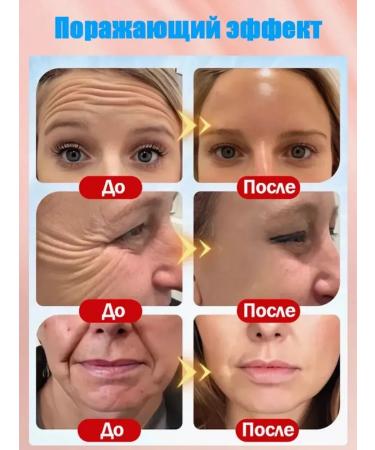 SADOER OFFICIAL Anti -aging nutrient cream increases the activity of the skin - Buy Online on GoSupps.com