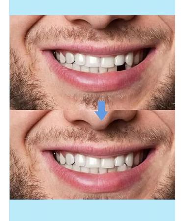 Affordable dentistry A copy of the tooth material for manufacturing 30ml - Buy Online on GoSupps.com