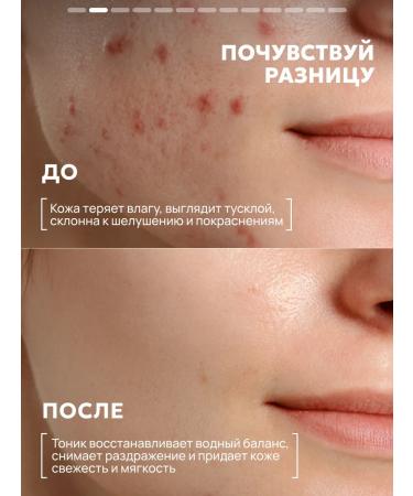 Semily Moisturizing facial toner - Buy Online on GoSupps.com