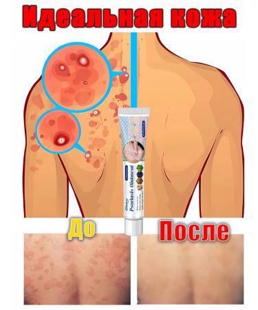 DRSKINVITA Skin care cream from psoriasis 20 g