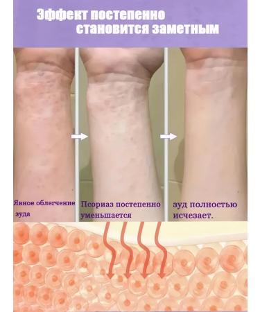 DRSKINVITA Skin care cream from psoriasis 20 g - Buy Online on GoSupps.com