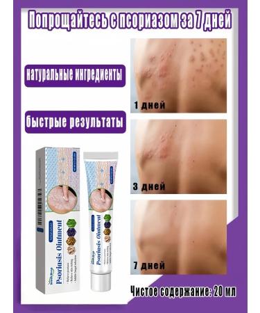 DRSKINVITA Skin care cream from psoriasis 20 g - Buy Online on GoSupps.com
