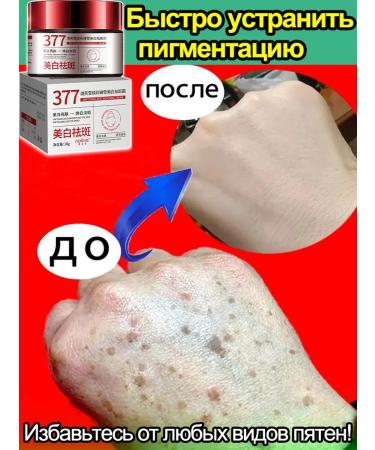 LYDIMOON Facial cream from spots moisturizing and rejuvenation